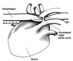 Generalized and diffuse dilation of esophagus preventing normal forward propulsion of ingesta. Persistent Right Aortic Arch Praa Canine Megaesophagus All About Me