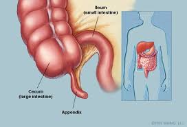 Hemorrhoid Picture Image On Medicinenet Com