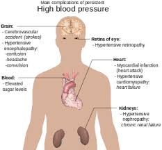 hypertension wikipedia