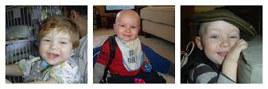Atypical teratoid rhabdoid tumor (atrt) of the central nervous system (cns) is a highly malignant embryonal neoplasm (grade 4 according to the world health organization classification) that typically occurs in children aged <3 years. The Lucky Ones Our Family S Journey With Atrt