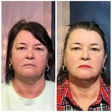 Angela Oh-Park Antipin, MD (@drangelasaestheticclinic) · Ridgeway, VA