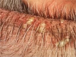 We did not find results for: Canine Impetigo In Puppies Veterinary Practice