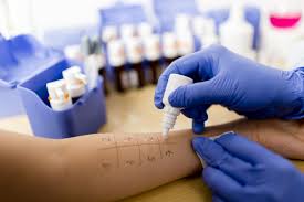 When people have an unpleasant reaction to something they ate, they often think that they have an allergy. Study Blood And Skin Prick Tests Failed To Diagnose Allergy Half The Time Snacksafely Com