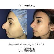 STEPHEN T. GREENBERG, MD