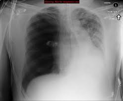 Only true fans will be able to answer all 50 halloween trivia questions correctly. Viewing Playlist Bbh 2nd Year Medical Students Quiz 1 Radiopaedia Org
