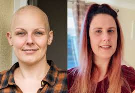Cervical Cancer Awareness Week: Lawshall's Clare Skinner and Lowestoft's  Laura Woods share their experiences of cervical cancer and the importance  of smear tests