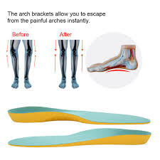 Soft cushioning insoles for high heels. Rdeghly Arch Support Insoles Shoe Insoles 5 Types Orthotic Corrective Arch Support Cushion Shoe Inserts Insoles Pads For Kids Walmart Canada