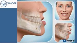 Introduction to Orthodontics