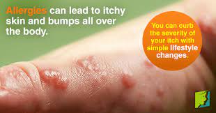 Itchy Bumps On The Skin Causes Itchy Bumps Itchy Skin Itchy Body