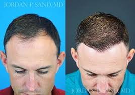 Sand Plastic Surgery of Spokane