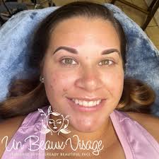 Un Beaux Visage, LLC