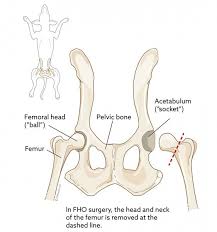 The bones of the hip include the femur, the ilium, the ischium, and the pubis. Femoral Head Ostectomy Fho In Dogs Vca Animal Hospital