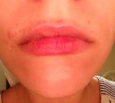 This Happens After Waxing What Gives Skincareaddiction