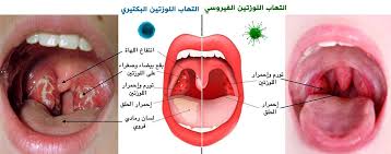 وقد وصفها الموفق عبد اللطيف البغدادي (ت. Ø¯ Ù Ùˆ Ø§Ø² Ø§Ù„Ù…Øº Ø§Ù…Ø³ Pa Twitter Ø³Ù„Ø³Ù„Ø© ØªØºØ±ÙŠØ¯Ø§Øª Ø¹Ù† Strep Throat Sore Throat Ø¥Ù„ØªÙ‡Ø§Ø¨ Ø§Ù„Ø­Ù„Ù‚ Ø§Ù„ÙÙŠØ±ÙˆØ³ÙŠ Ø§Ù„Ø¨ÙƒØªÙŠØ±ÙŠ Ø§Ù„Ø£Ø¹Ø±Ø§Ø¶ Ø§Ù„Ø¹Ù„Ø§Ø¬ ØªØ­Ø³ÙŠÙ† Ù†Ù…Ø· Ø§Ù„Ø­ÙŠØ§Ø© Ø¹Ù„Ø§Ø¬Ø§Øª Ù…Ù†Ø²Ù„ÙŠØ© Ø­ÙŠØ« Ø£Ù† Ø£Ù„Ù… Ø§Ù„Ø­Ù„Ù‚ Ù„Ù‡ Ø¹Ø¯ Ø©