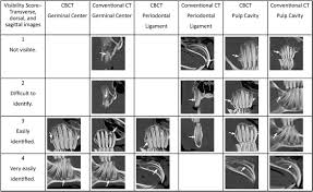 Frontiers Clinical Application Of Cone Beam Computed