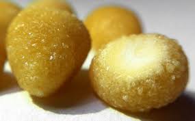 Cystine Stones Are Rare Kidney Stones Produced By People Who Have Cystinuria Kidney Stones Kidney Food