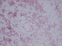 What diseases are caused by pseudomonas aeruginosa? Pseudomonas Fluorescens Wikipedia