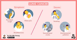 But lung cancer also occurs in people who never smoked and in those who never had prolonged. The Guide To Lung Cancer Treatment In Singapore 2021