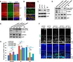 Find tips and projects for c, c++, c#, and google go. A Novel C Jun N Terminal Kinase Jnk Signaling Complex Involved In Neuronal Migration During Brain Development Journal Of Biological Chemistry