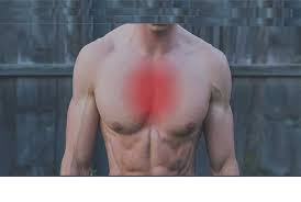 We did not find results for: Pectus Excavatum Pain In Chest Back Ribs How To Manage