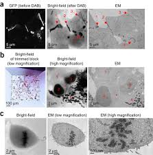 Myocardial perfusion is an imaging test. Electron Microscopy Using The Genetically Encoded Apex2 Tag In Cultured Mammalian Cells Nature Protocols