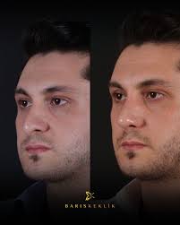 Am 23. Mai bin ich in Salzburg (Österreich)! 🇦🇹 Ich freue mich darauf,  Sie persönlich in der Klinik von Dr. Fatma Gürel zu treffen. Haben Sie  Fragen rund um Plastische Chirurgie? Jetzt