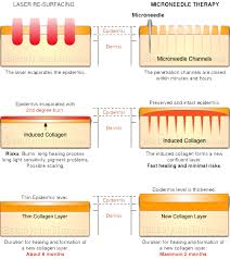Ibeauty Pen Disposable Needle Tips Ii