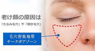マスク蒸れで急増中 たるみ毛穴 や 開き毛穴 で老け顔に セレブスタイルジャパン 老け顔 セレブスタイル スキンケア