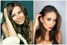 gambarайза / мой отец пытался раз / как выглядела айза д / переживающая кризис / сболтнула лишнее: Ajza Anohina Pokazala Rezultaty Plastiki Spustya Dve Nedeli Moskovskie Novosti Moskovskij Biznes Portal