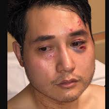 Andy ngo interviewed on new megyn kelly show episode. Why This Journalist Was Attacked By Antifa In Portland Oregon Wjla