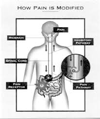 Image result for Pain Disorder