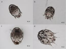 Image result for Sarcoptes scabiei