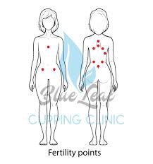 العلاج الحجامة الحجامة يزيل الدم والأنسجة السوائل مختلطة مع المواد الضارة المحتملة لا ترتبط الفوائد العلاجية للحجامة الح In 2020 Hijama Hijama Points Cupping Therapy