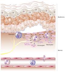 Eosinophils, Basophils, and Neutrophils in Bullous Pemphigoid