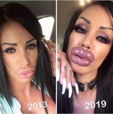 As you can see they have become more arched and elevated than before. 19 People Who Took Plastic Surgery Too Far In 2021 Plastic Surgery Gone Wrong Bad Celebrity Plastic Surgery Plastic Surgery Photos