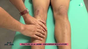 ▶️ programmes, émissions et séries de tf1 en replay sur mytf1. Allo Docteurs Emission Du Vendredi 14 Septembre 2018 En Streaming Replay France 5 France Tv