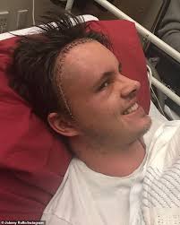 'after an unexpected week of seizures and excruciating headaches it is with a heavy heart that i have to let you know i now have another. Wdi9kjyk2c4sqm