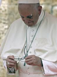Pope Francis has a black eye after ...