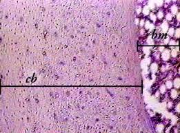 In the h&e section, the rapidly formed, immature bone (aka woven bone) view image exhibits a greater affinity for hematoxylin and higher cell density compared to mature bone. Bone Compact Decalcified C S