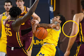 I apologize for any violation. Watch Eli Brooks Has Tooth Knocked Out During Michigan Basketball S Win Over Minnesota