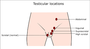 Cryptorchidism is the absence of one or both testes from the scrotum, with the missing testes in the inguinal canal. Testicular Locations Normally Both Testes Locate At The Bottom Of Download Scientific Diagram