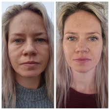 Here we are 2 weeks after my upper eyelid surgery. 1st time wearing  mascara. I'm genuinely delighted with the results ☺️