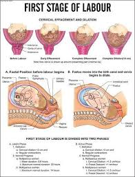 First Stage Of Labour Chart Stages Of Labor First Stage