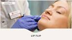 Video ZO GAAT EEN LIP FLIP BEHANDELING FACELAND - YouTube