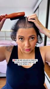 No se me volvió a caer el cabello desde que use set tónico 🍃👀  #caidacabello #Caspa #paratiiiiiiiiiiiiiiiiiiiiiiiiiiiiiii #fypシ