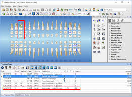 Charting Referred Procedures Dentrix Magazine