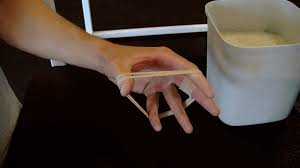 Tennis elbow, or lateral epicondylitis, is a very painful condition on the outside of the elbow from an overuse injury. Tennis Elbow Treatment Video 3 Of 3
