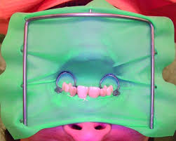 Image result for ochrana chrupu