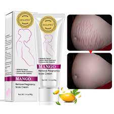 This cream contains sea buckthorn, which also cures burns and cuts. Buy Rtopr Mango Stretch Marks And Scar Cream Stretch Marks And Scar Removal Cream For Pregnancy Best Body Moisturizer 40g Online In Uae B07hh4d4qv