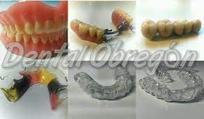 Laboratorio protésico dental Obregón en Oliva de la Frontera, Badajoz